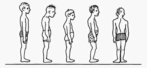 Violation of the posture