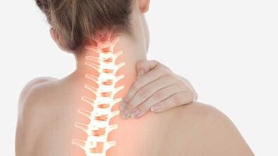 Main manifestations of cervical osteocondrosis