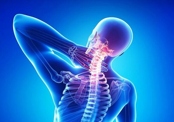 Pain with osteocondrosis in cervical spine