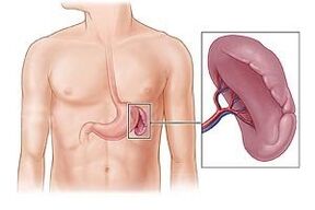 Dalan's pathology as a cause of pain under the left shoulder blade